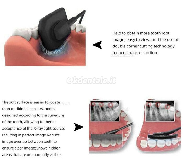 Sensore a Raggi X Rvg Immagine Digitale Dentale Sistema Imaging Intraorale Dentale